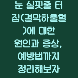 눈 실핏줄 터짐(결막하출혈)에 대한 원인과 증상, 예방법까지 정리해보자 챕터1
